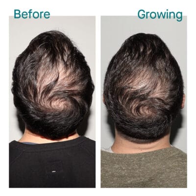 Before & Growing – Alan, 1 year