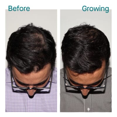 Before & Growing – Aman, 10 months