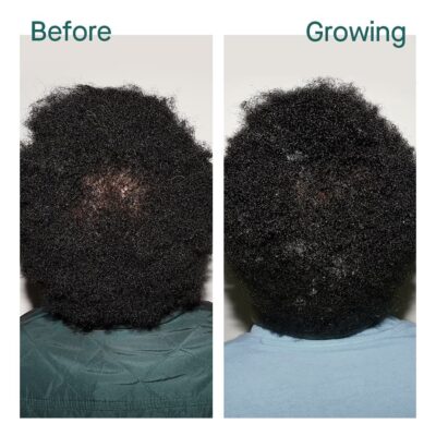 Before & Growing – Justeenia, 3 months