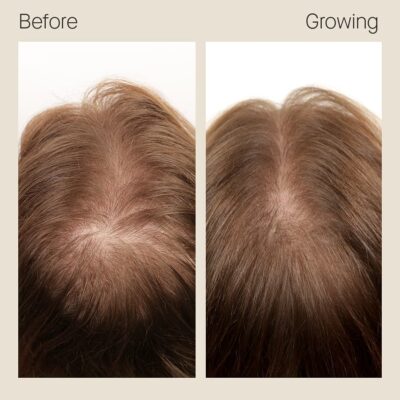 Before & Growing – Lera, 4 months