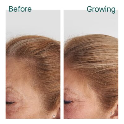 Before & Growing – Marina, 6 months