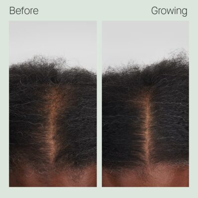 Before & Growing – Wendy, 6 months (top view)