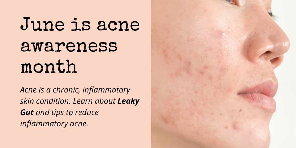 National Acne Awareness Month is in June Chronic Inflammation