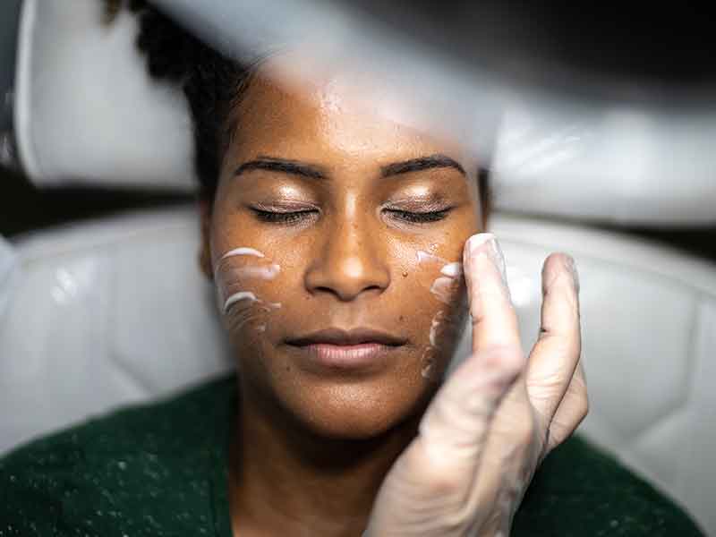 Why does Chemical Skin Peel Work?