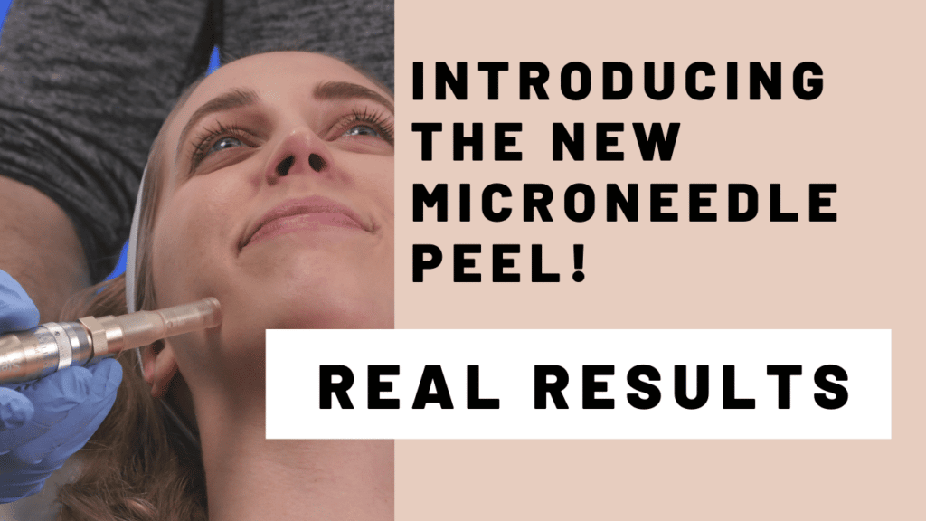 microneedle peel