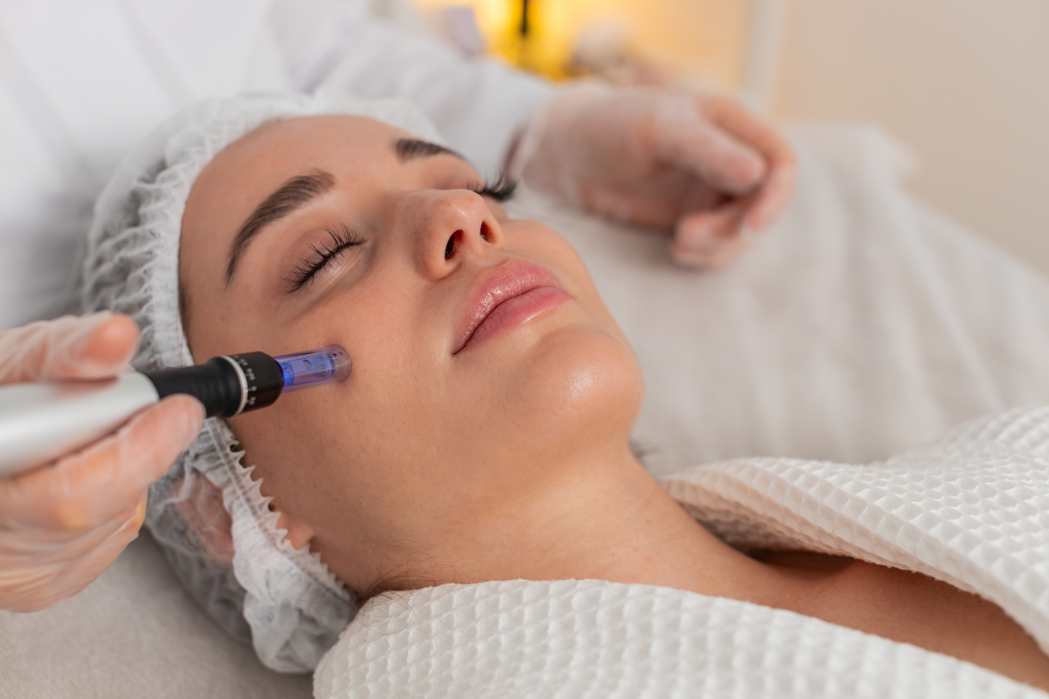 How does your skin build collagen? Professional microneedling stimulates natural collagen production to improve skin texture and firmness.