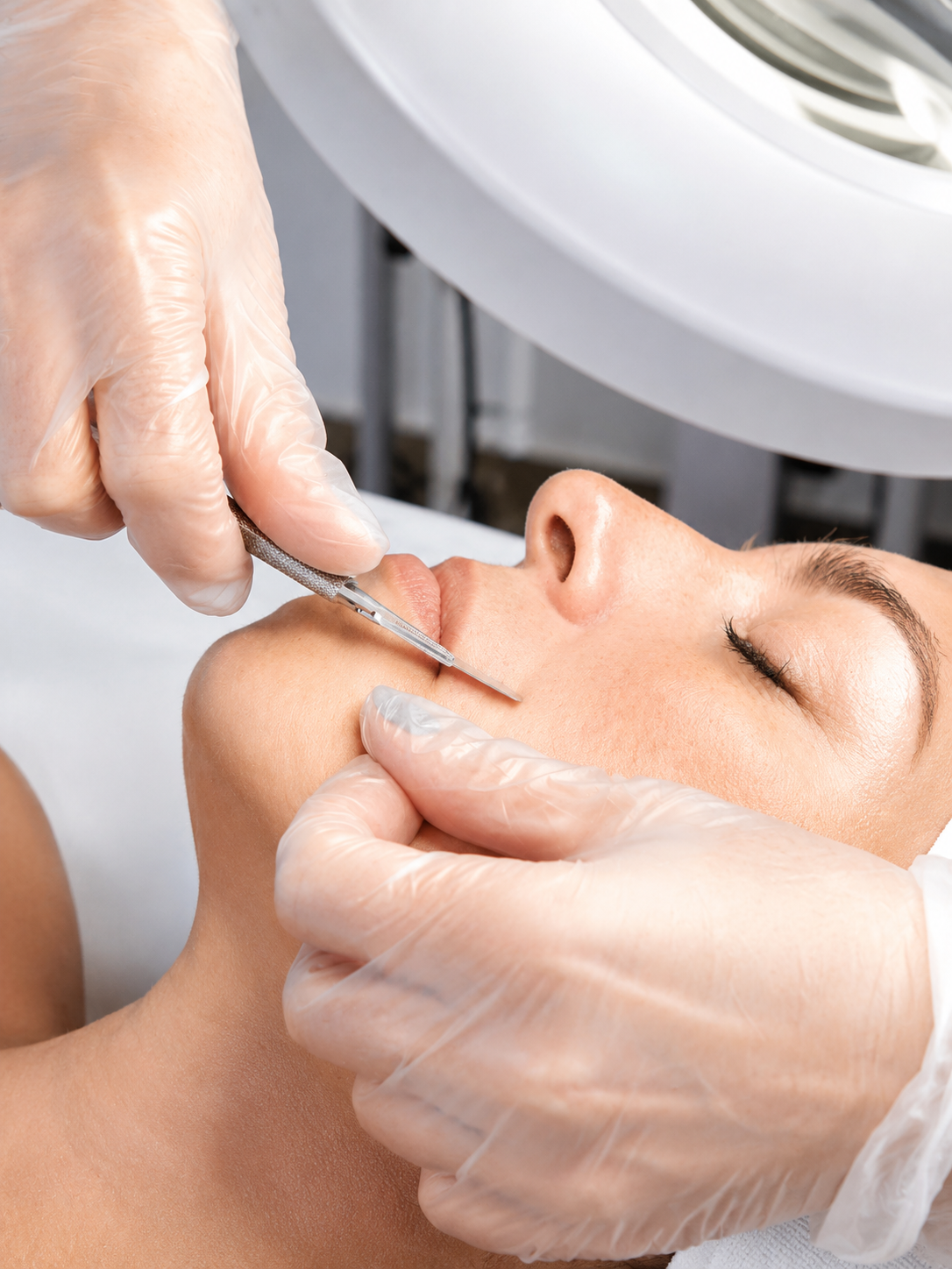 Dermaplaning treatment for dermaplaning vs. microdermabrasion comparison