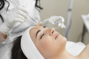 Woman receiving a professional chemical peel treatment