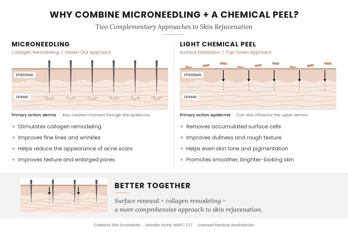 Microneedling With Chemical Peel Benefits Benefits of microneedling with chemical peel for fine lines, pigmentation, enlarged pores and skin texture